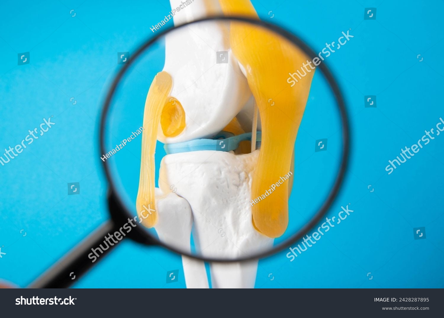 Medical mockup of a knee joint on a blue background under a magnifying glass. Knee joint problems concept. Bursitis, tendonitis and gout. Orthopedics #2428287895