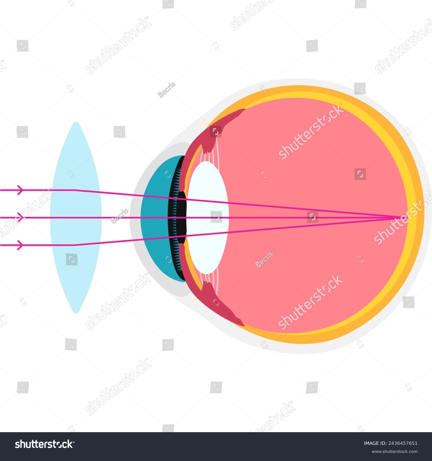 longsighted academic diagram structure anatomy - Royalty Free Stock ...