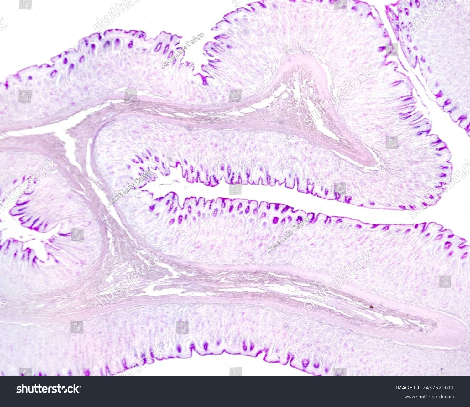 Gastric wall mucosa showing many folds with an axis of submucosa. In the mucosa, the mucous surface epithelium and foveolar cells of gastric pits show a great PAS positivity. PAS method. #2437529011