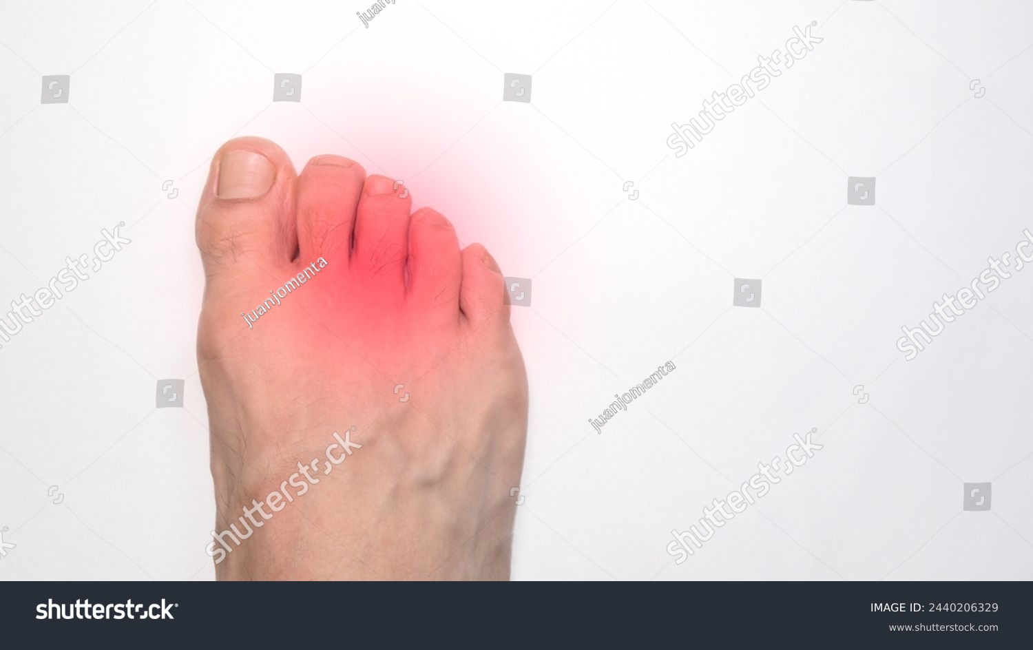 A Right foot toes of a person with a red mark representing pain #2440206329