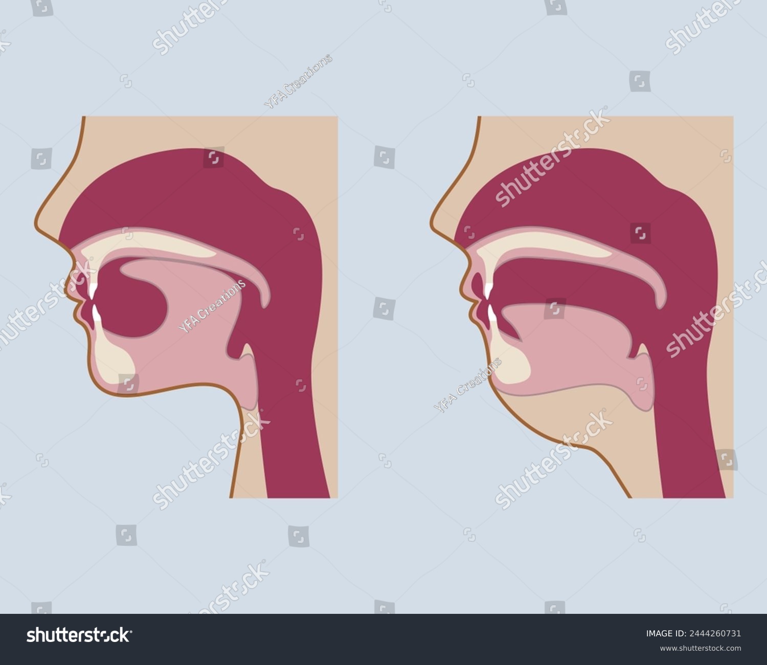 Mewing Tongue Posture Before And After - Royalty Free Stock Vector 