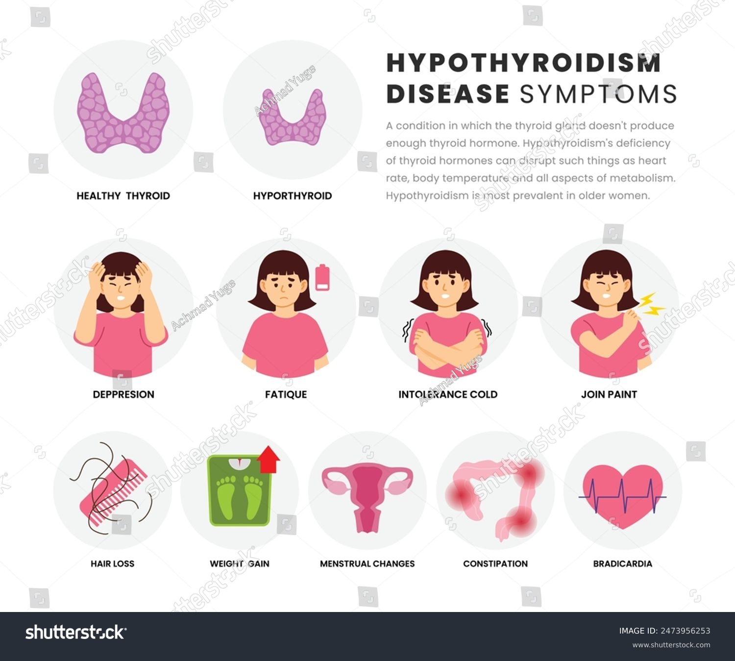 Hypothyroidism symptoms infographic medical - Royalty Free Stock Vector ...