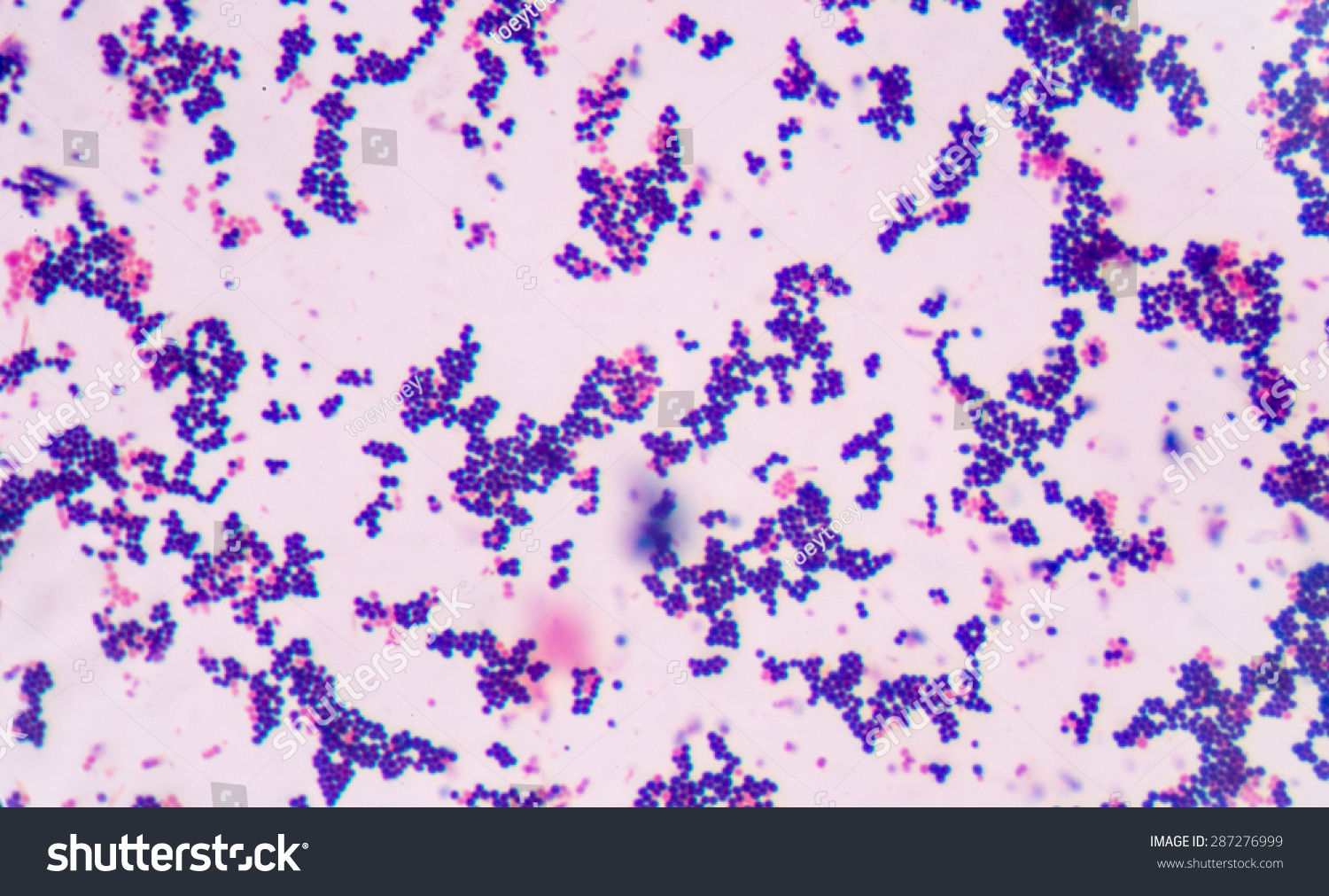 Gram staining, also called Gram's method, is a method of differentiating bacterial species into two large groups (Gram-positive and Gram-negative). #287276999