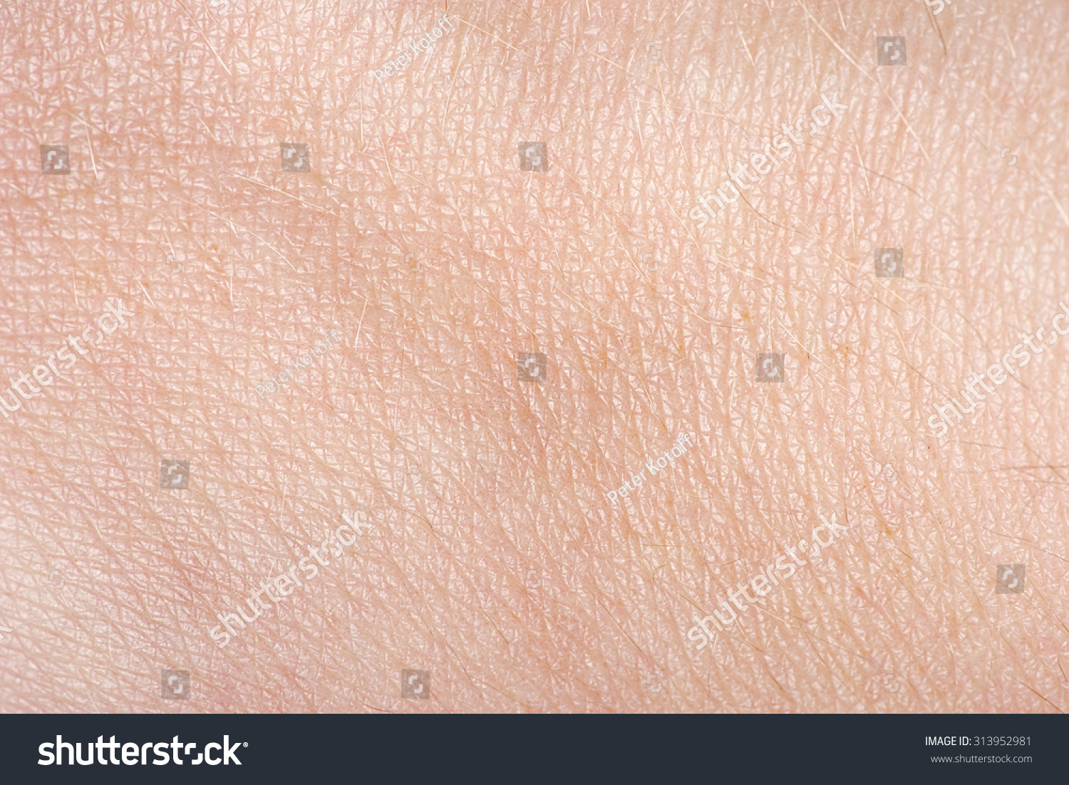 The texture of the skin #313952981