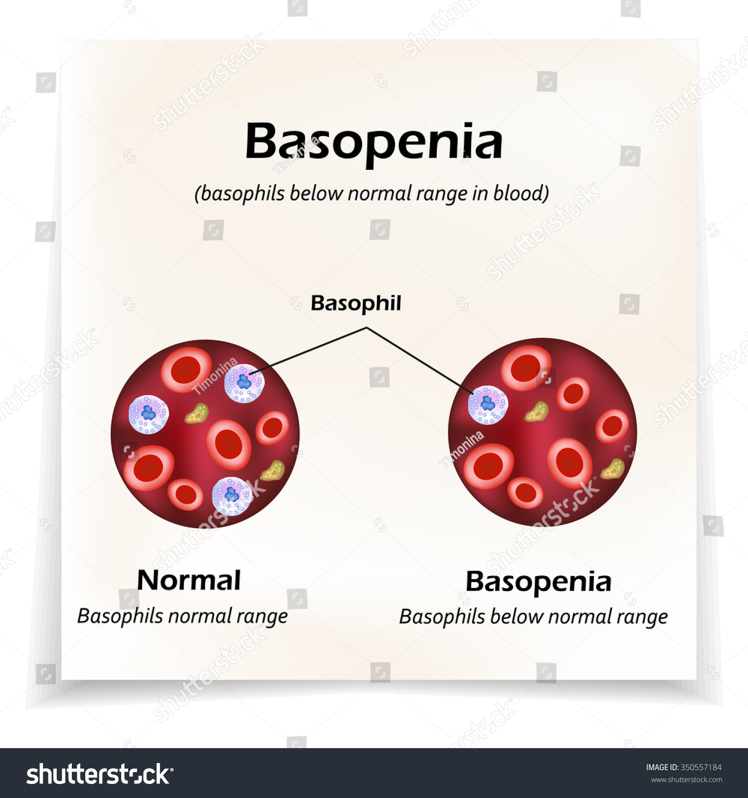 why-are-absolute-monocytes-high