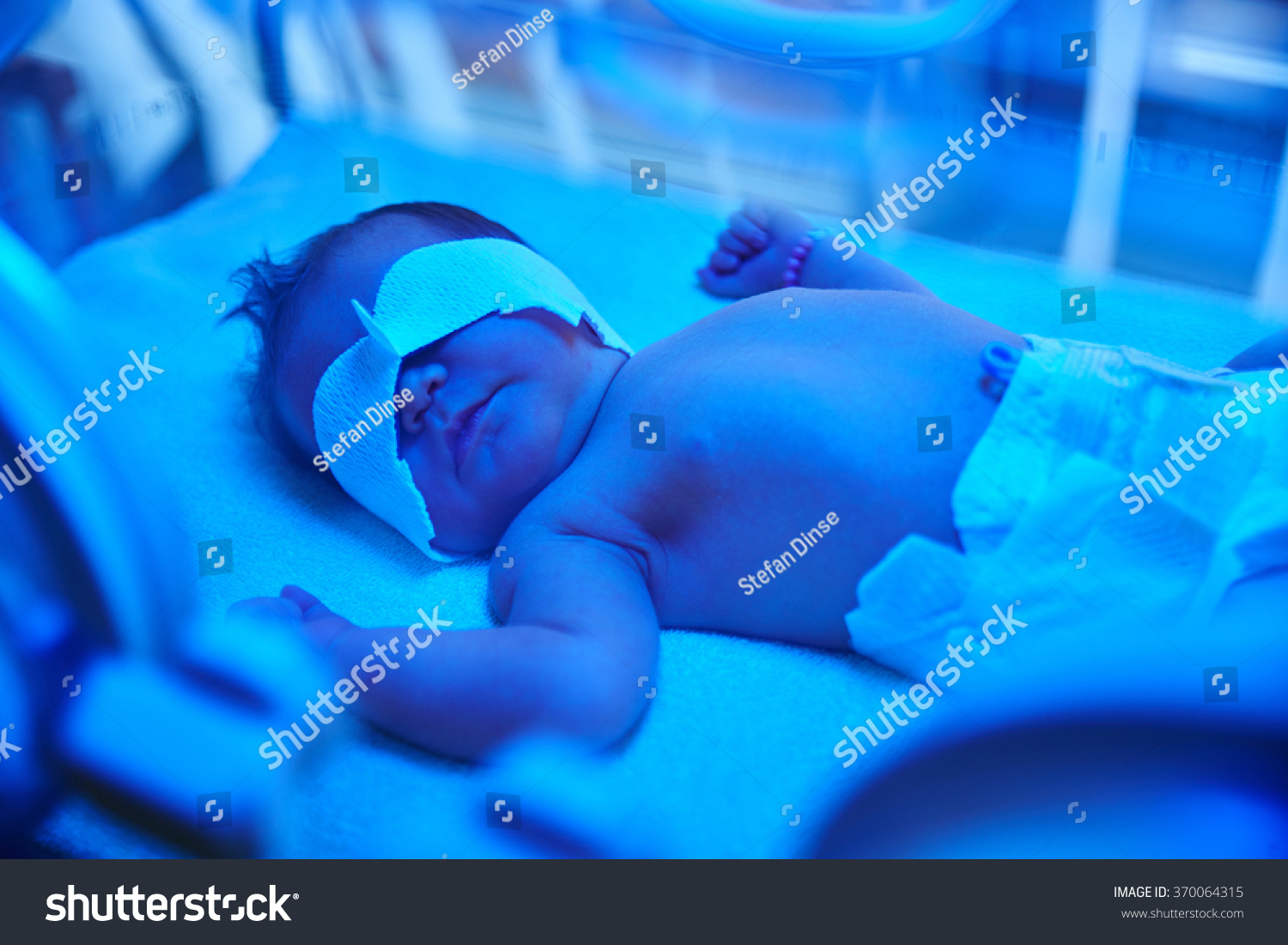 Newborn photo light therapy #370064315