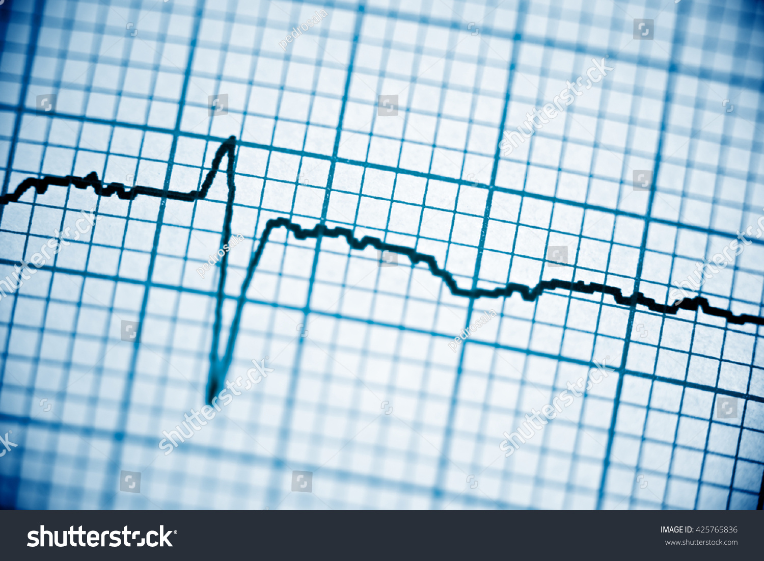 Close up of an electrocardiogram in paper form. #425765836