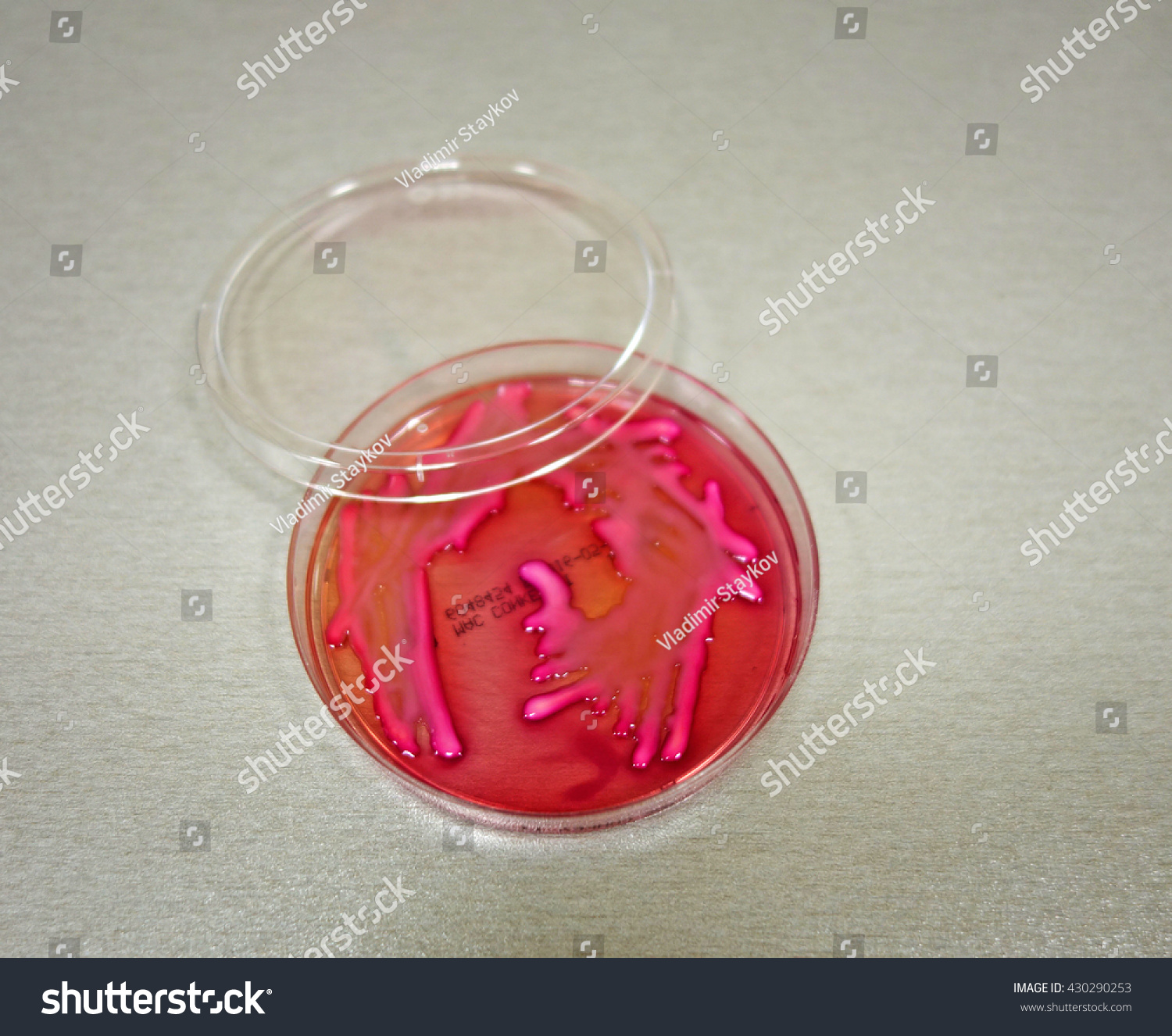 Colonies of Klebsiella pneumoniae growing in a - Royalty Free Stock ...