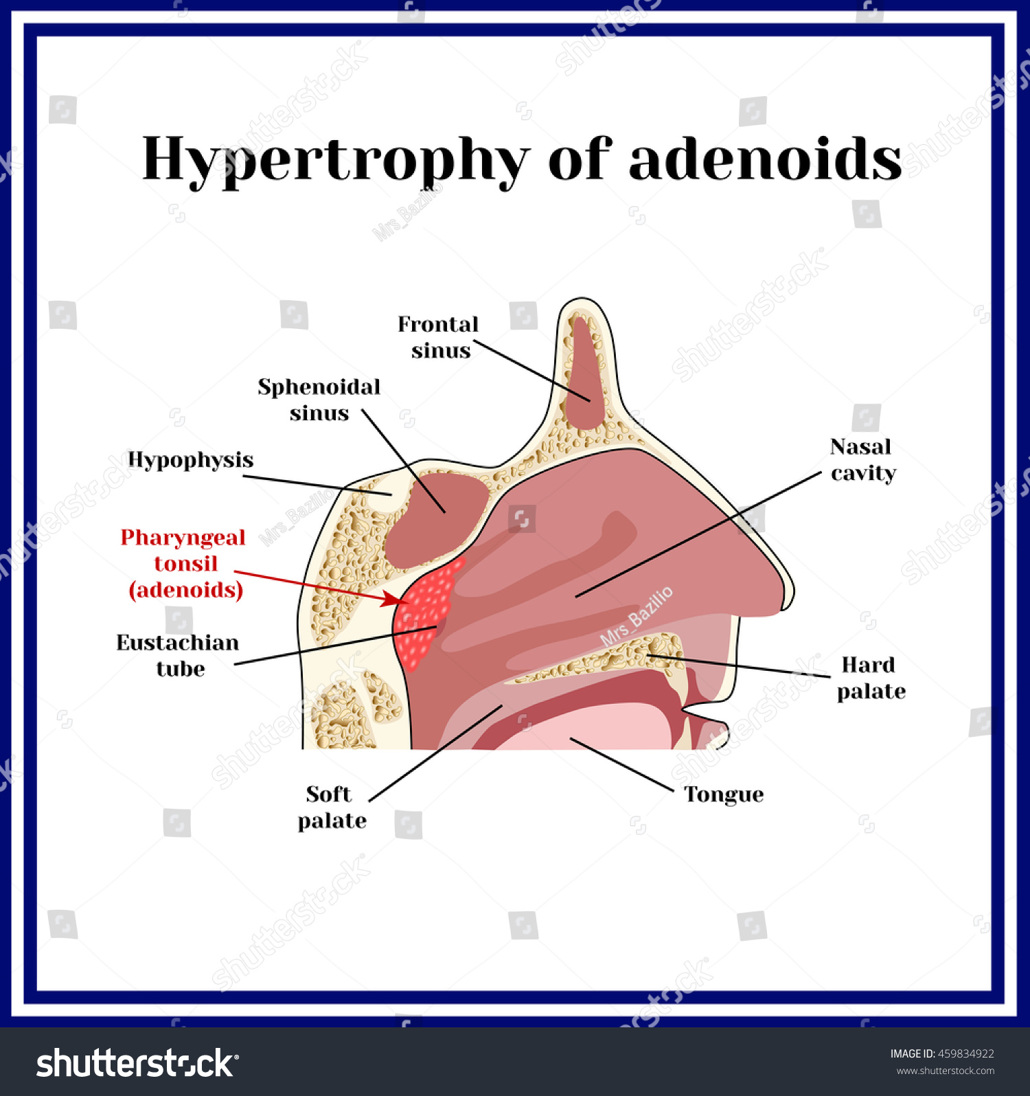 Location of adenoids.The structure of the - Royalty Free Stock Vector ...