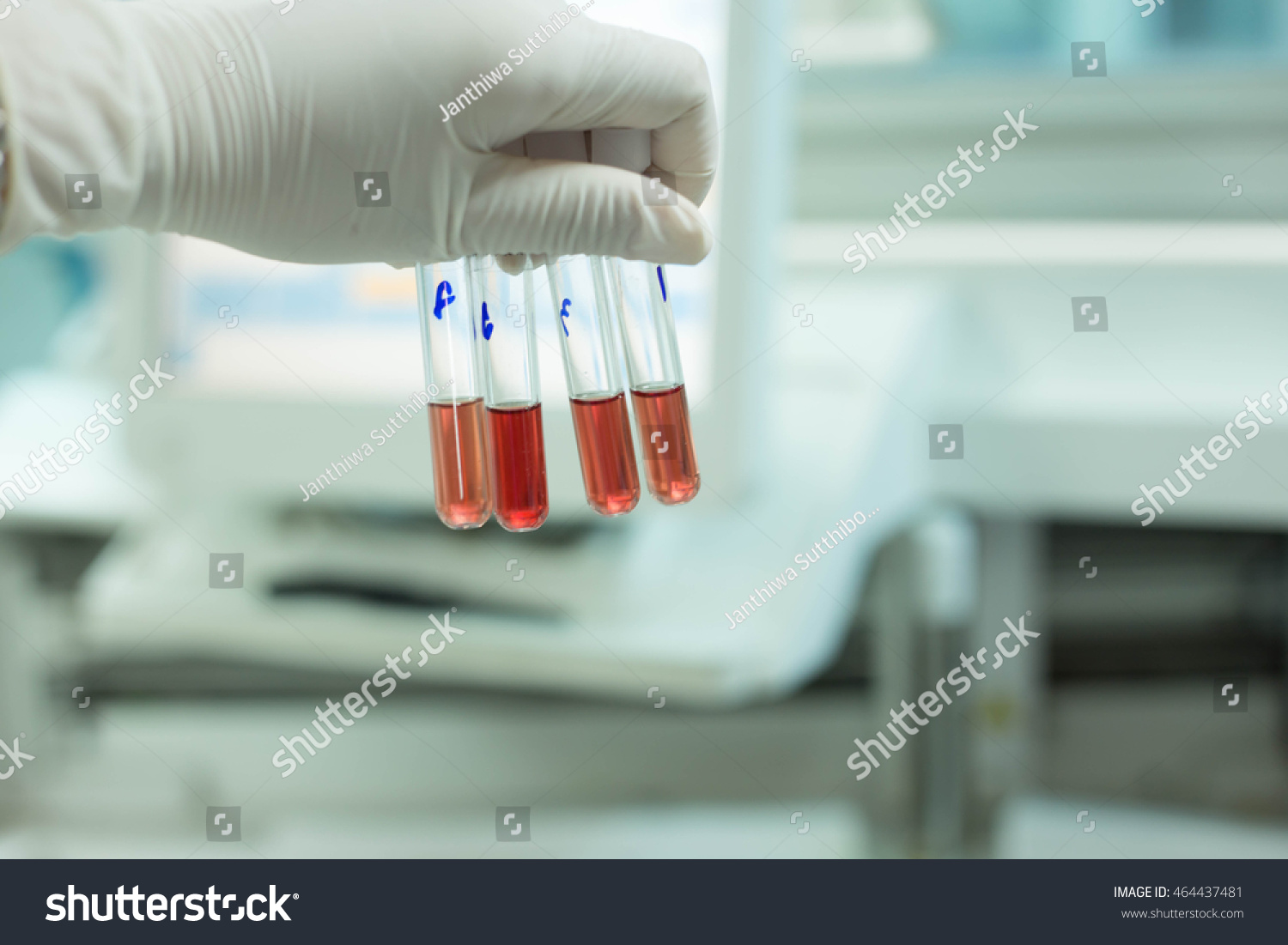 DCIP, laboratory test #464437481