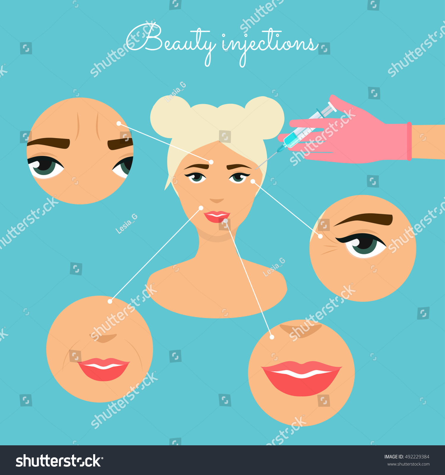 Beauty injections. Different types of injections Beauty. Micro plastic surgery concept. Female rejuvenation treatment infographics. #492229384