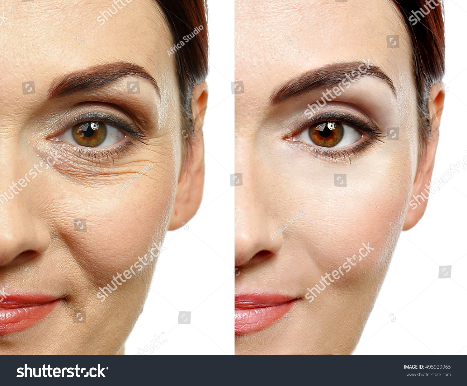 Woman face before and after cosmetic procedure. Plastic surgery concept. #495929965