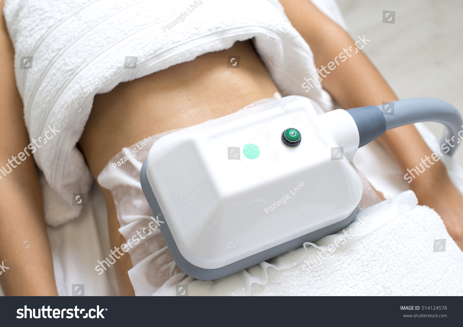 young woman getting cryolipolyse treatment in cosmetic cabinet #514124578