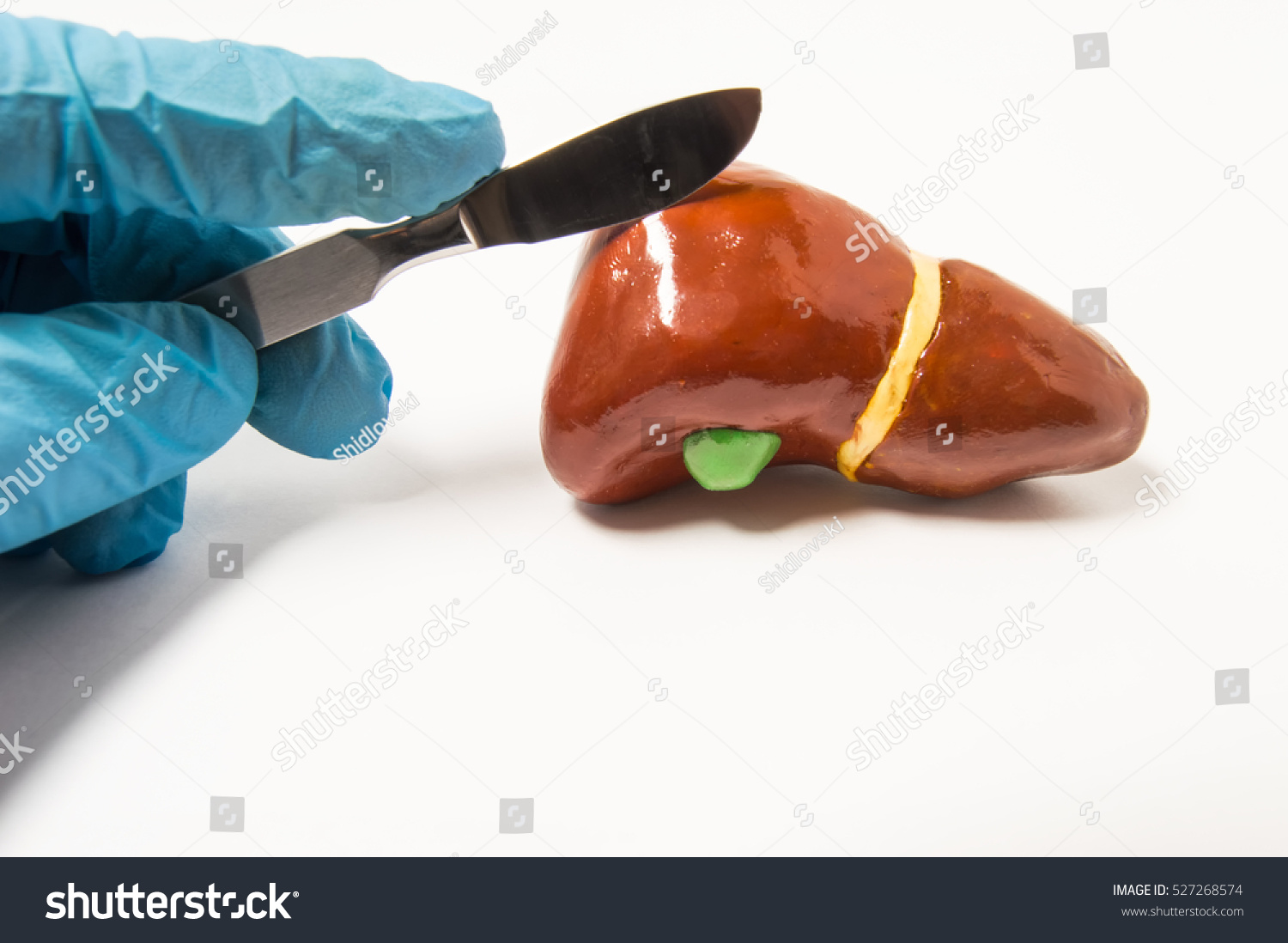 Surgeon's hand in blue latex glove holding scalpel over anatomical figure of human liver. Concept that symbolizes process of surgery treatment of liver diseases such as cancer, hydatid disease ets. #527268574