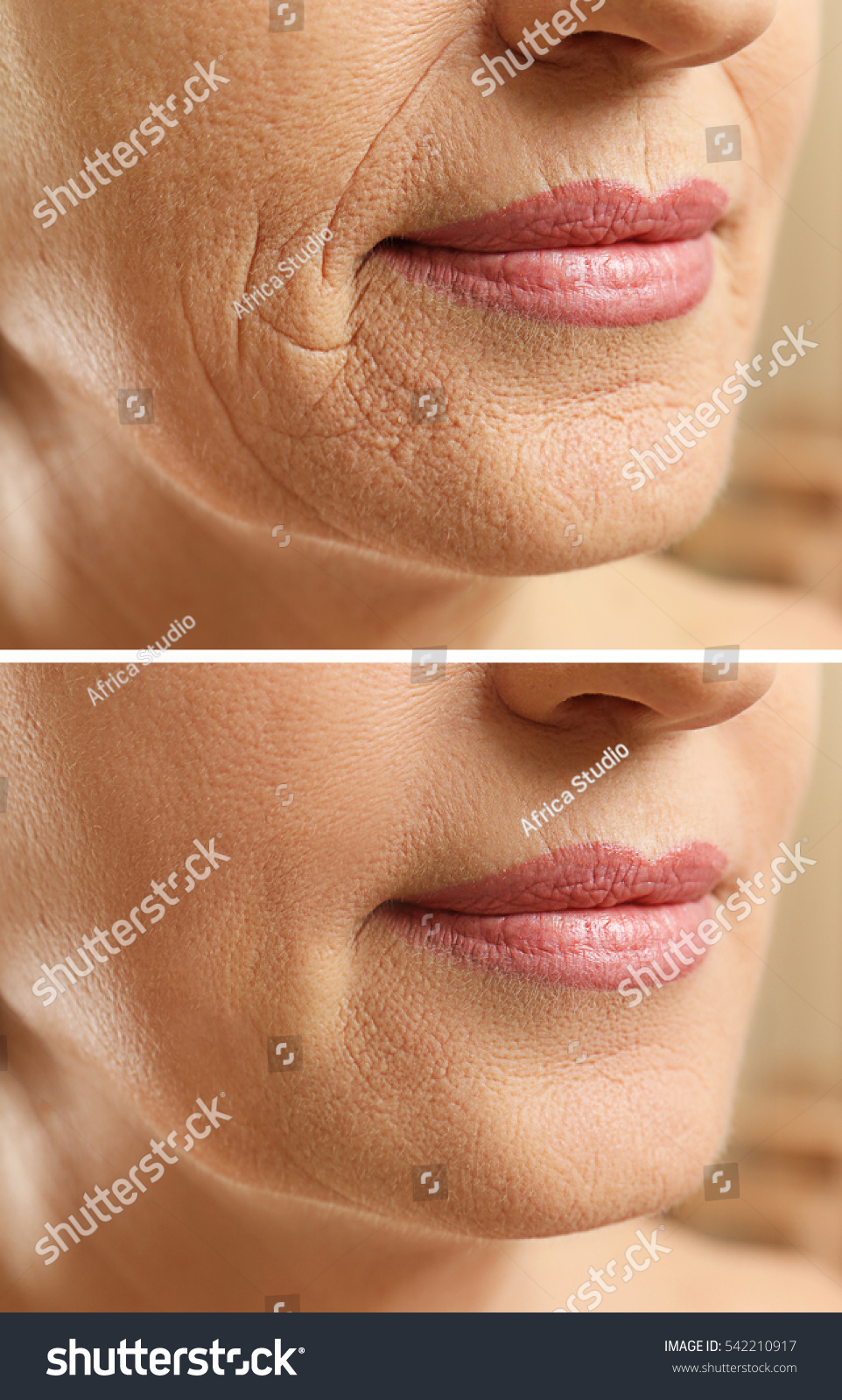 Mature woman face before and after cosmetic procedure. Plastic surgery concept. #542210917
