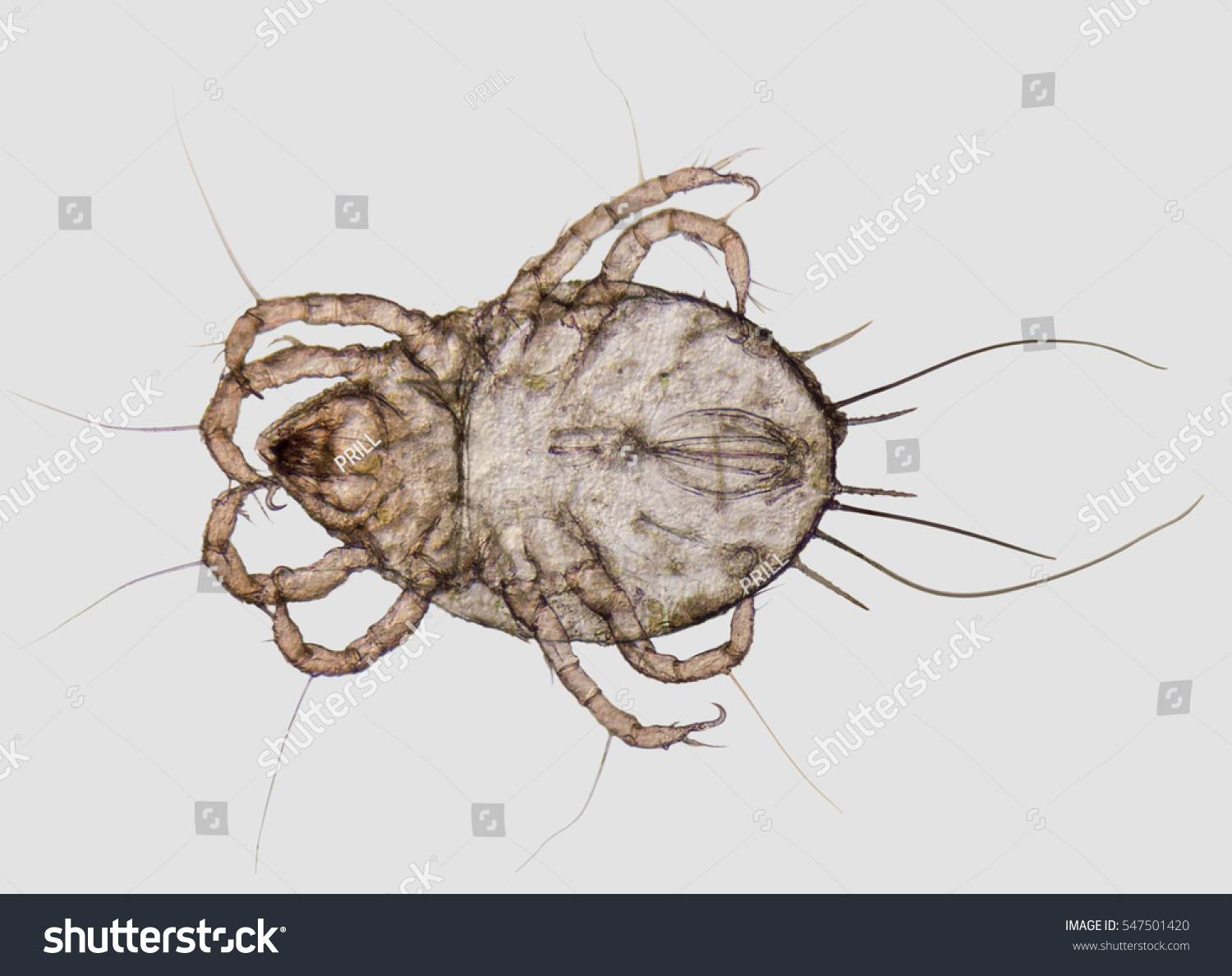 microscopic shot showing a house dust mite #547501420