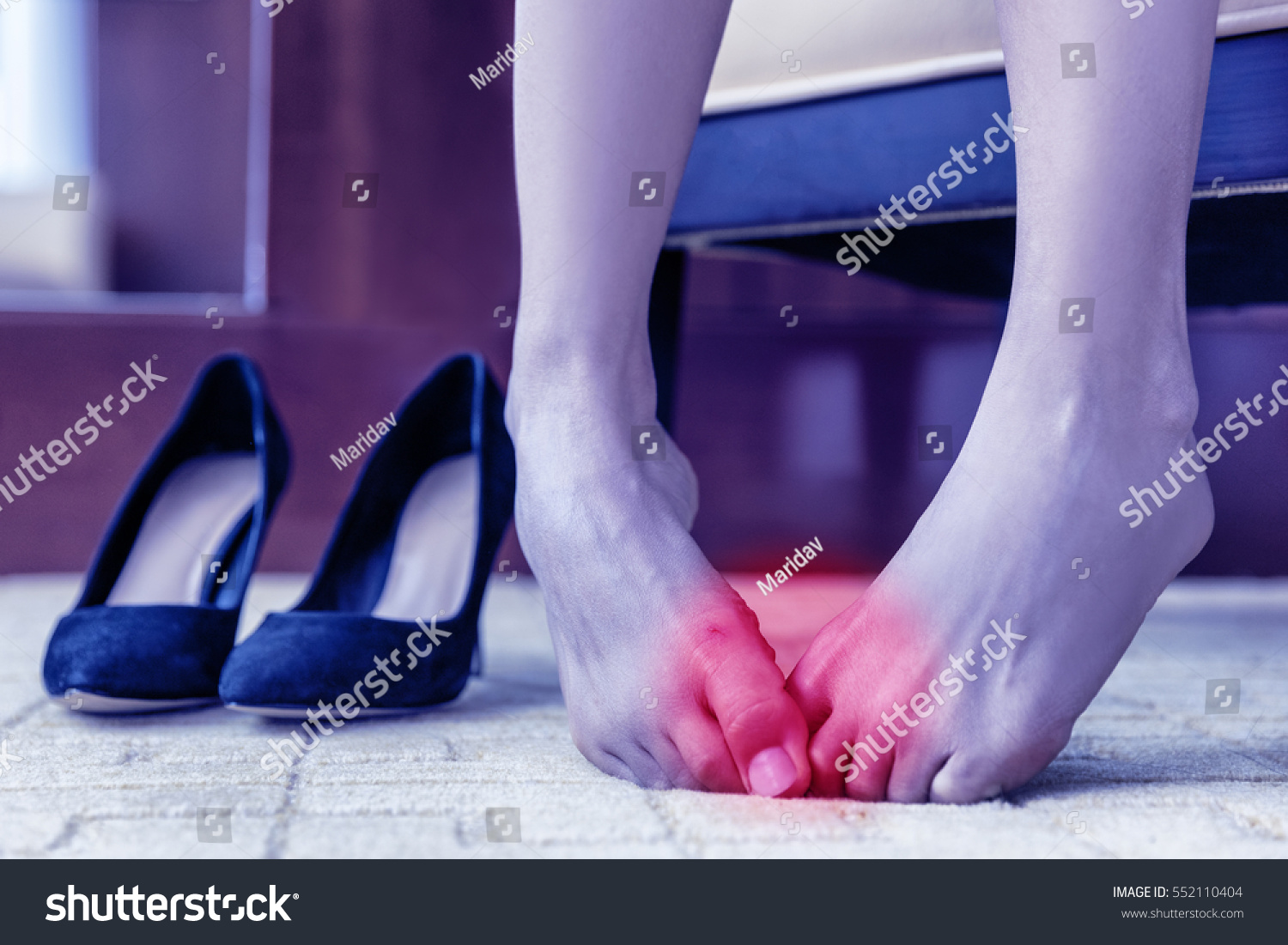 Medical concept. Foot pain. Body health problem, healthy feet swollen joints or blisters, wounds on skin. Painful barefoot woman at home or office with high heels in the background #552110404