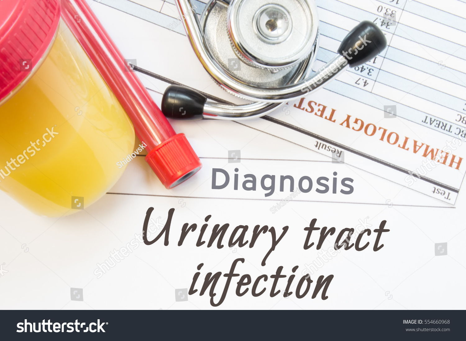 Urinary tract infection diagnosis. Lab container with urine sample, test tube with blood, stethoscope and blood test results on white note inscribed with  urologic disease Urinary tract infection #554660968