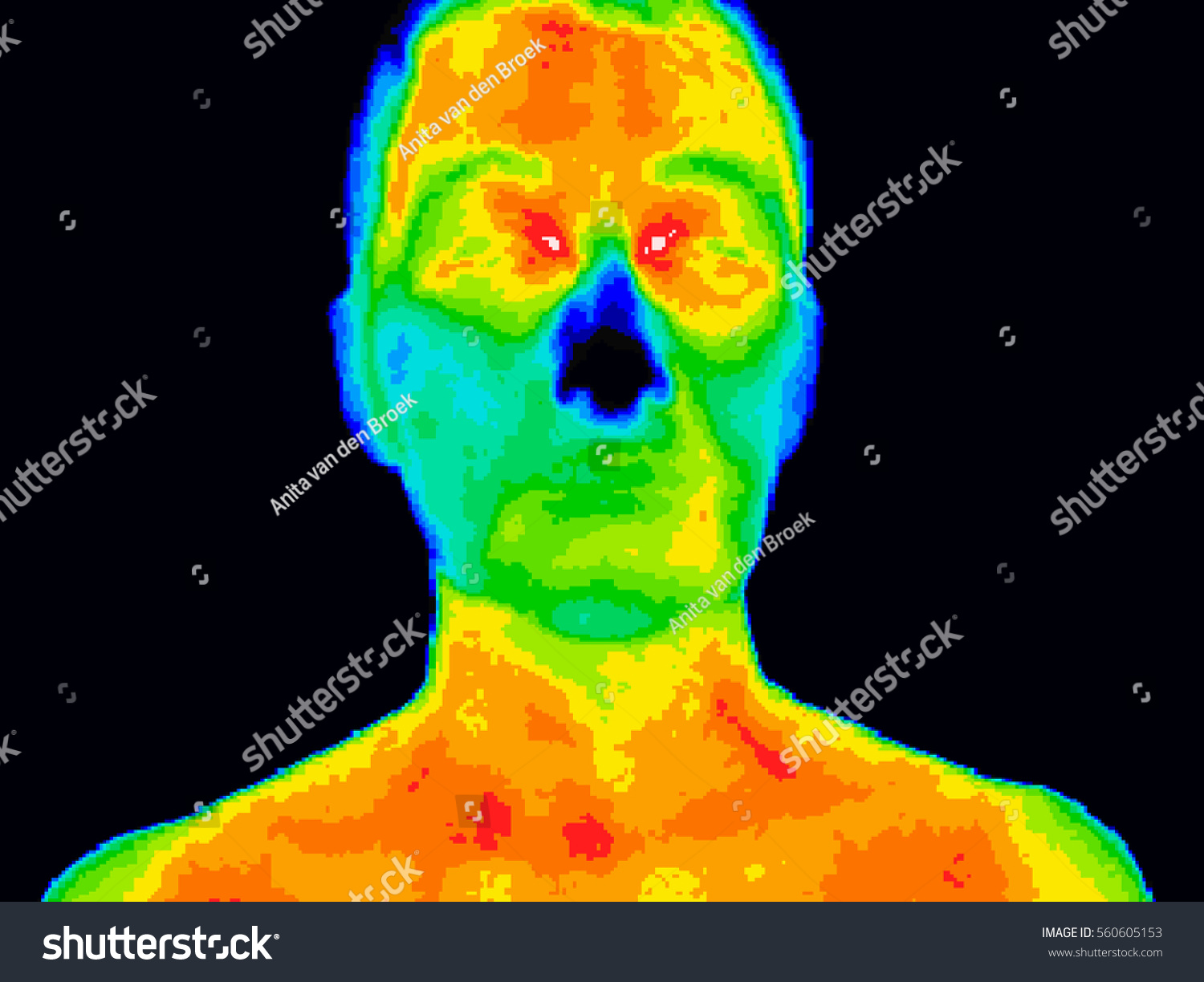 Thermographic image of a human face showing different temperatures in a range of colors from blue showing cold to red showing hot which can indicate inflammation. #560605153