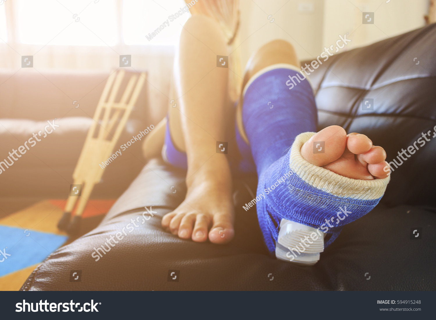 broken leg in a plaster cast with soft-focus in the background. over light #594915248