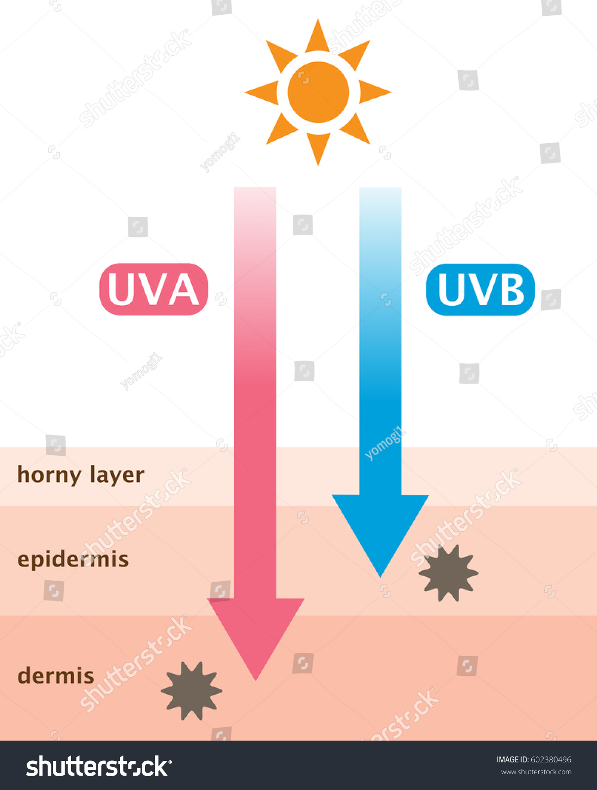 infographic skin illustration. the difference - Royalty Free Stock ...