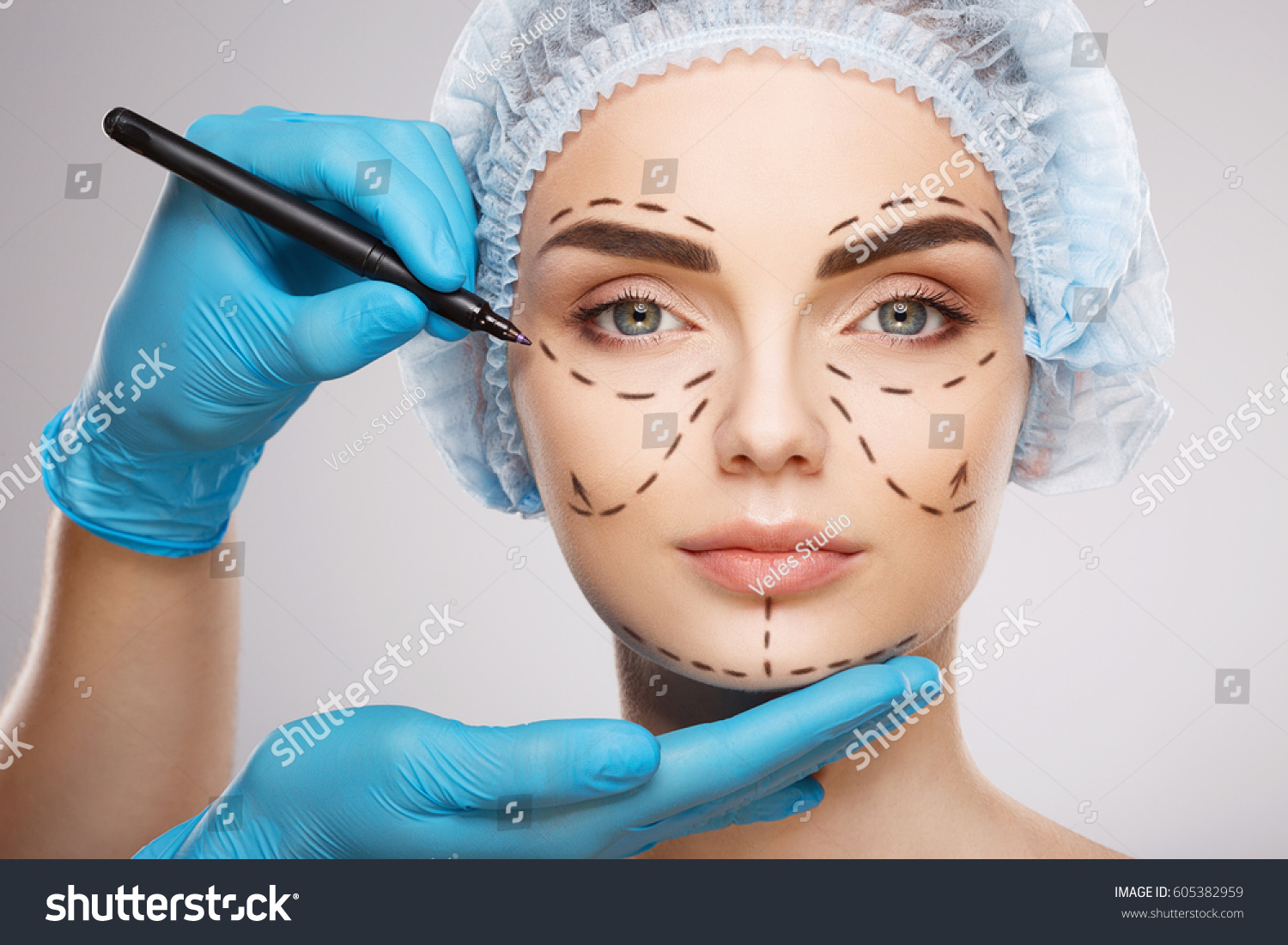 Pretty girl with dark eyebrows wearing blue medical hat at studio background, doctor's hands wearing blue gloves drawing perforation lines on face, plastic surgery concept. #605382959