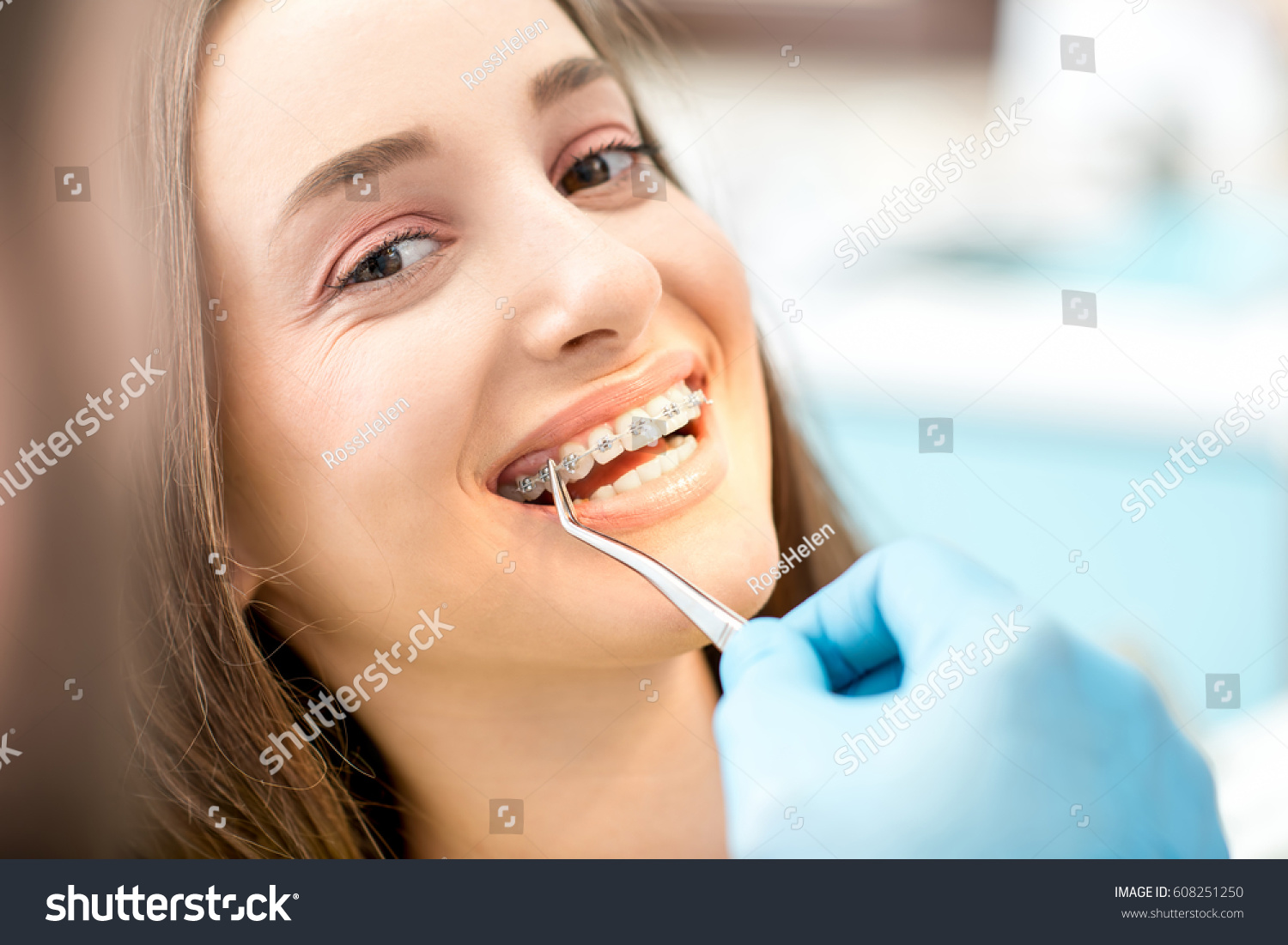 Putting dental braces to the woman's teeth at the dental office #608251250