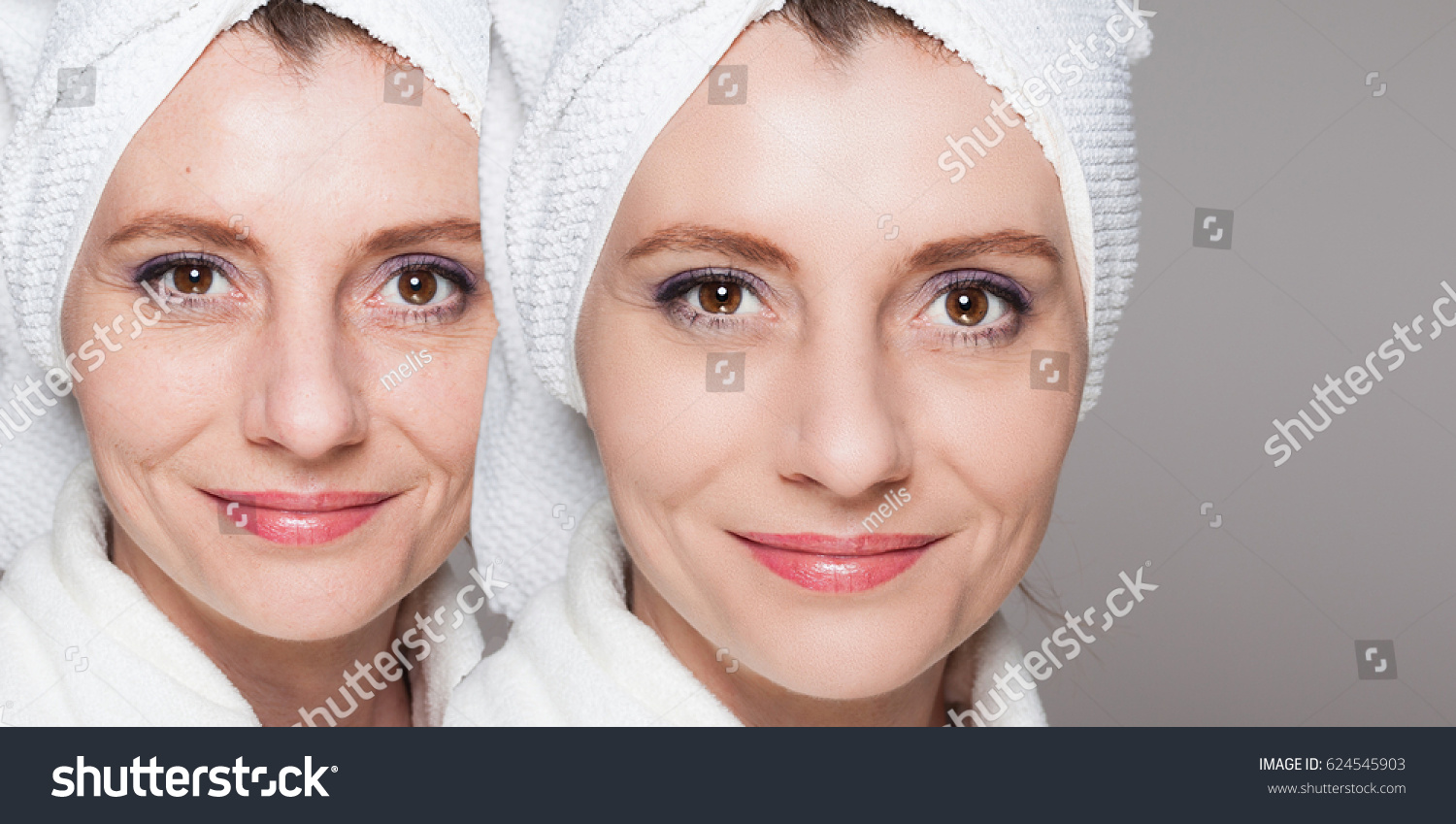 happy woman after beauty treatment - before/after shots - skin care, anti-aging procedures, rejuvenation, lifting, tightening of facial skin #624545903