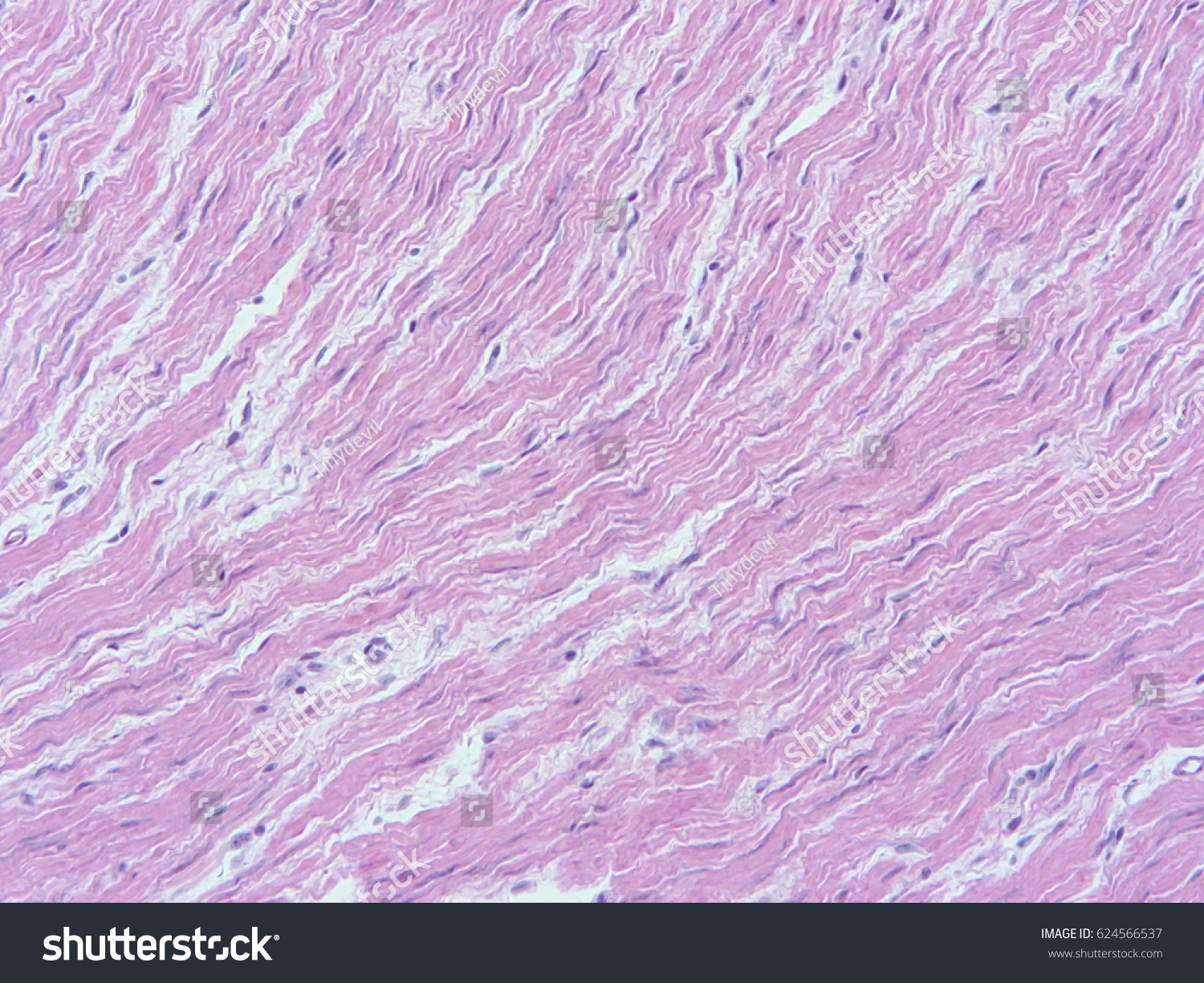 Histology of smooth muscle of uterine wall , - Royalty Free Stock Photo ...