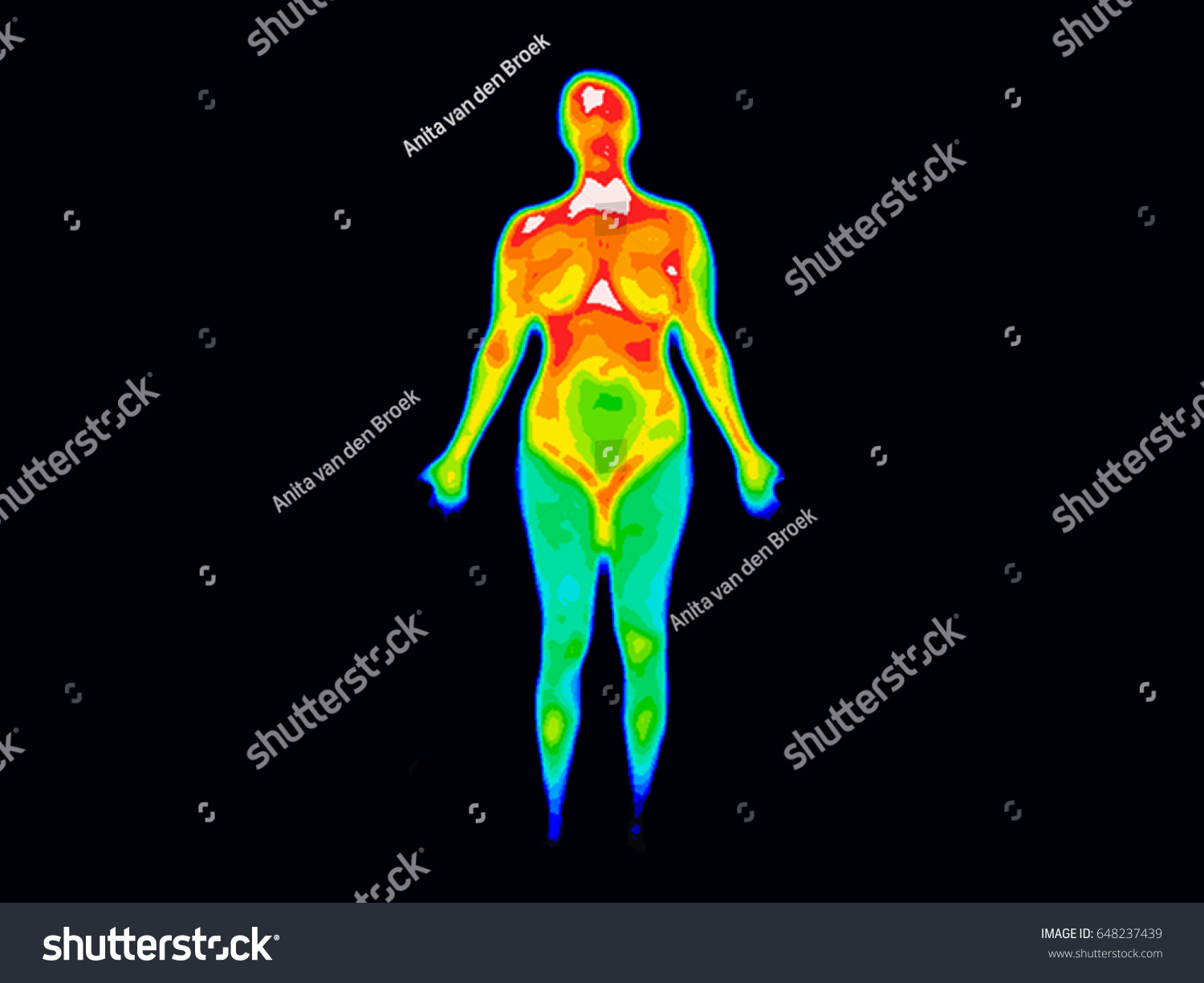 Thermographic image of the front of the whole body of a woman with photo showing different temperatures in range of colors from blue showing cold to red showing hot, can indicate joint inflammation.  #648237439