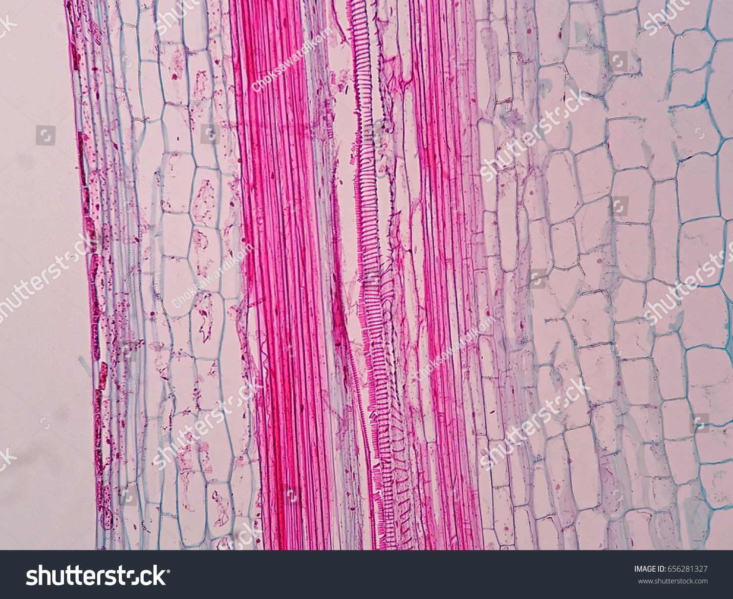 Plant vascular tissue under microscope view. #656281327