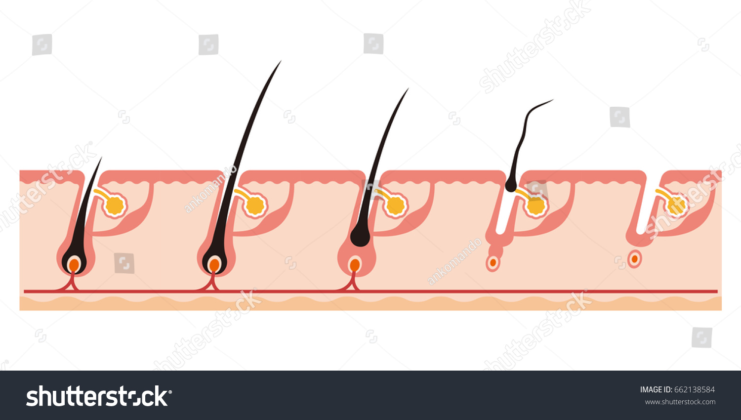 Illustration of a hair cycle - Royalty Free Stock Vector 662138584 ...