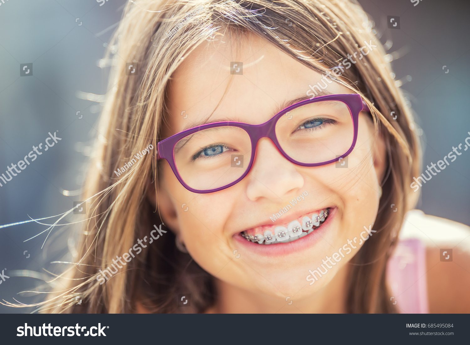 Happy smiling girl with dental braces and glasses.  #685495084
