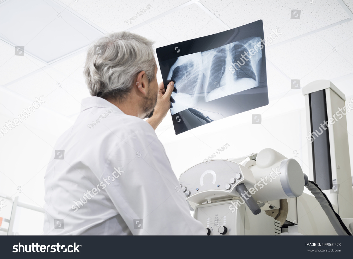 Male Doctor Analyzing Chest X-ray In Examination Room #699860773
