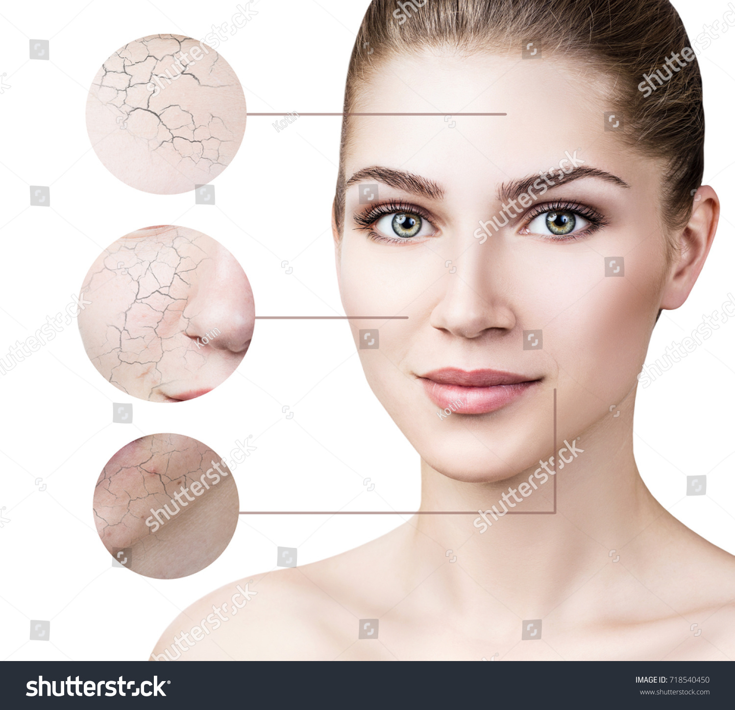 Zoom circle shows facial skin before moistening. #718540450