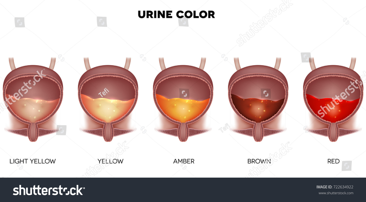 Urine color chart from light yellow till red - Royalty Free Stock Photo ...