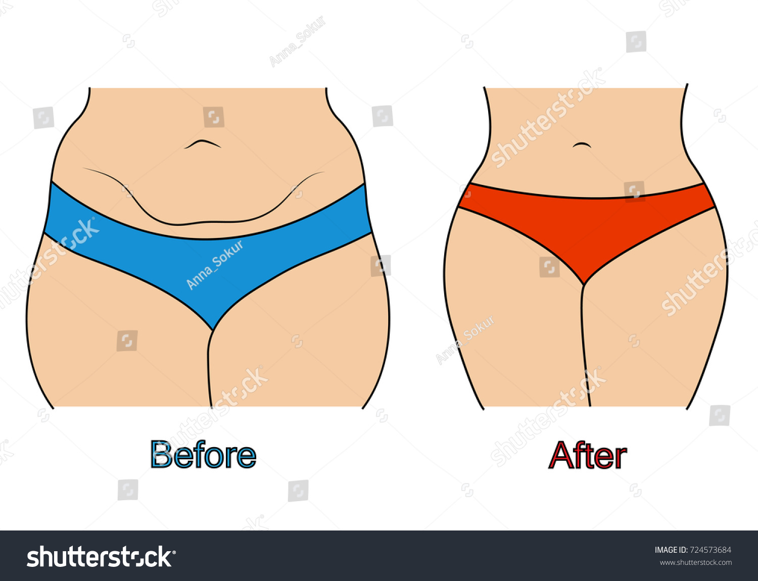 Woman Body Shape Before And After Diet Or Royalty Free Stock Vector 724573684 5595