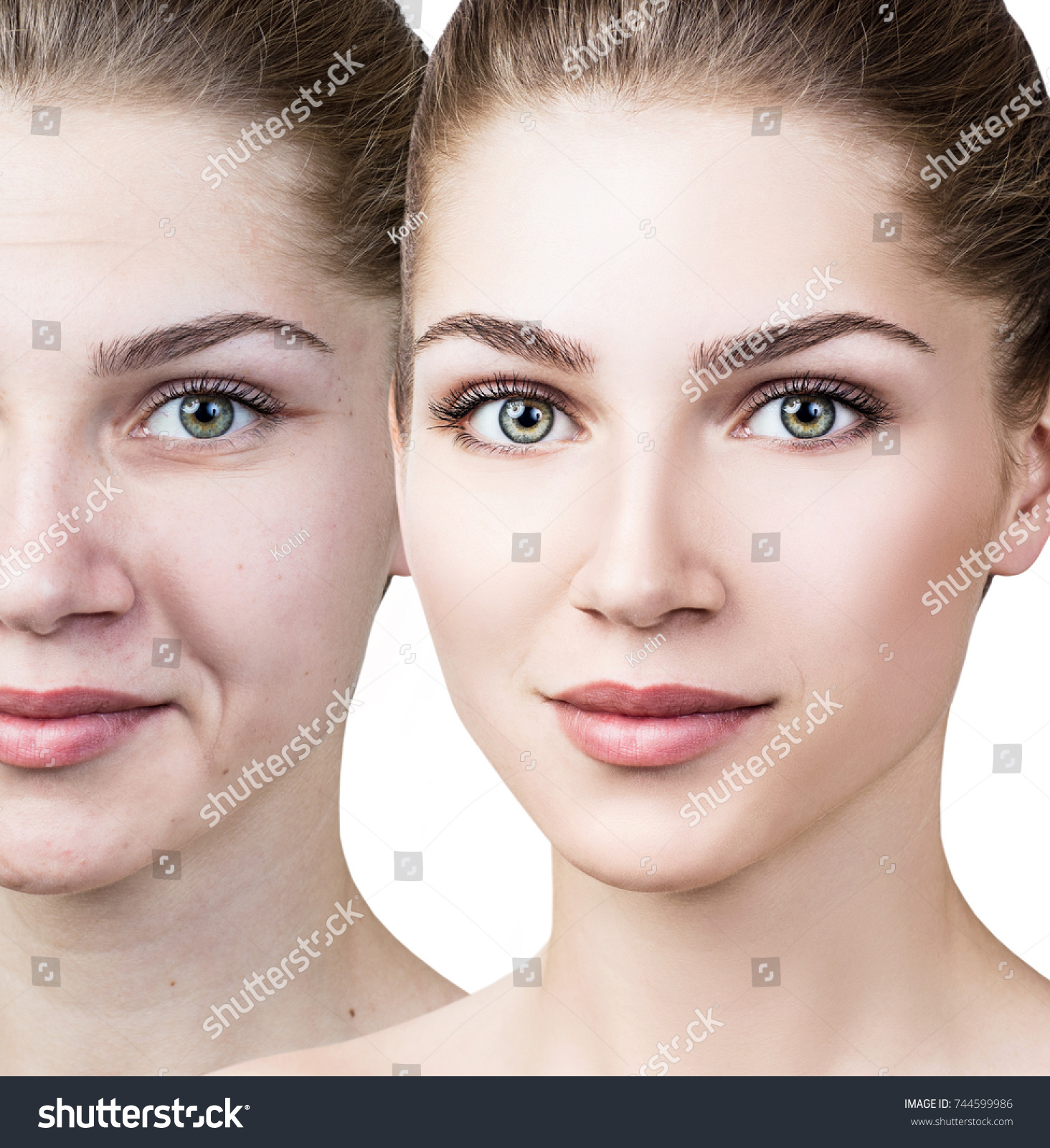 Woman's face before and after rejuvenation. #744599986