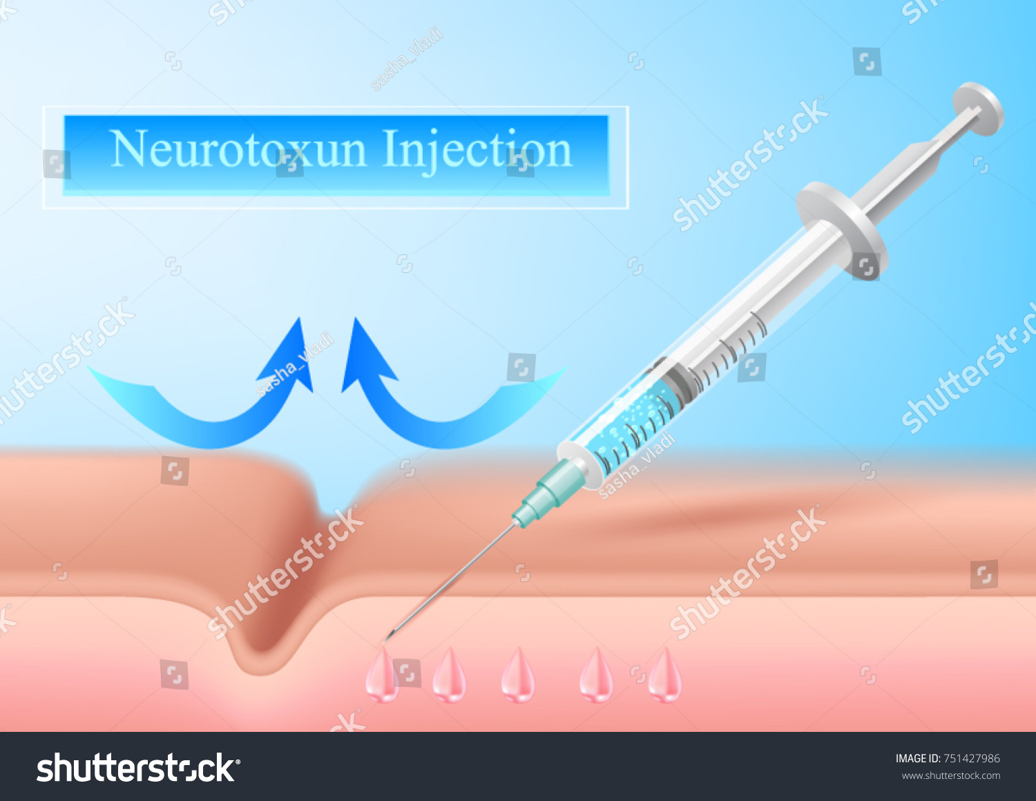 neurotoxin injection.Vector Illustrated  cosmetology Botox injections. Infographics  of medical cosmetic procedures for face skin. #751427986