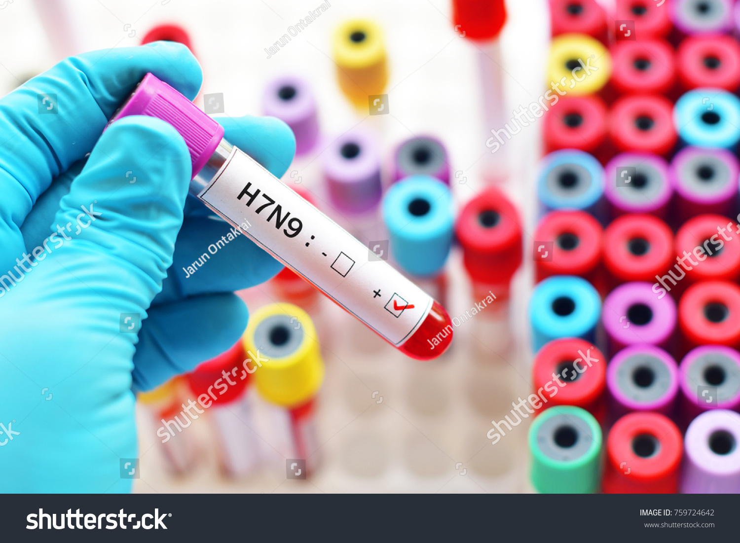 Blood sample positive with H7N9 Avian influenza virus #759724642