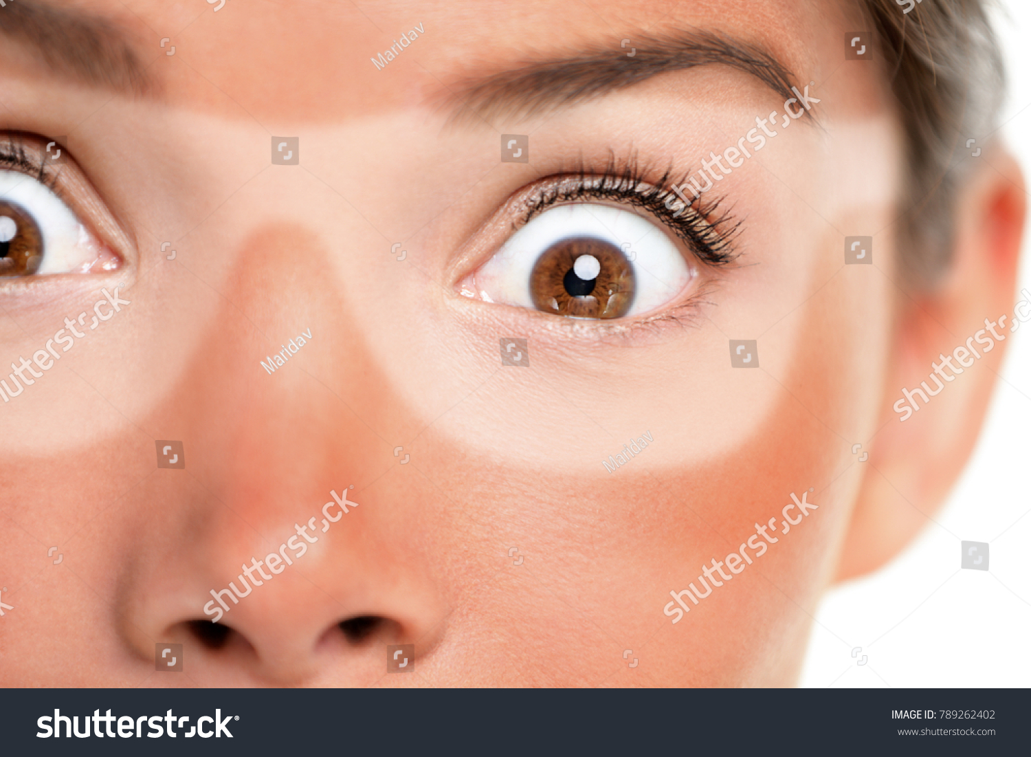 Sunburn tan lines of sunglasses, red painful skin. Scared Asian woman shocked with funny expression forgot to put sunscreen on face on summer vacation. Suntan skin cancer facial care concept. #789262402