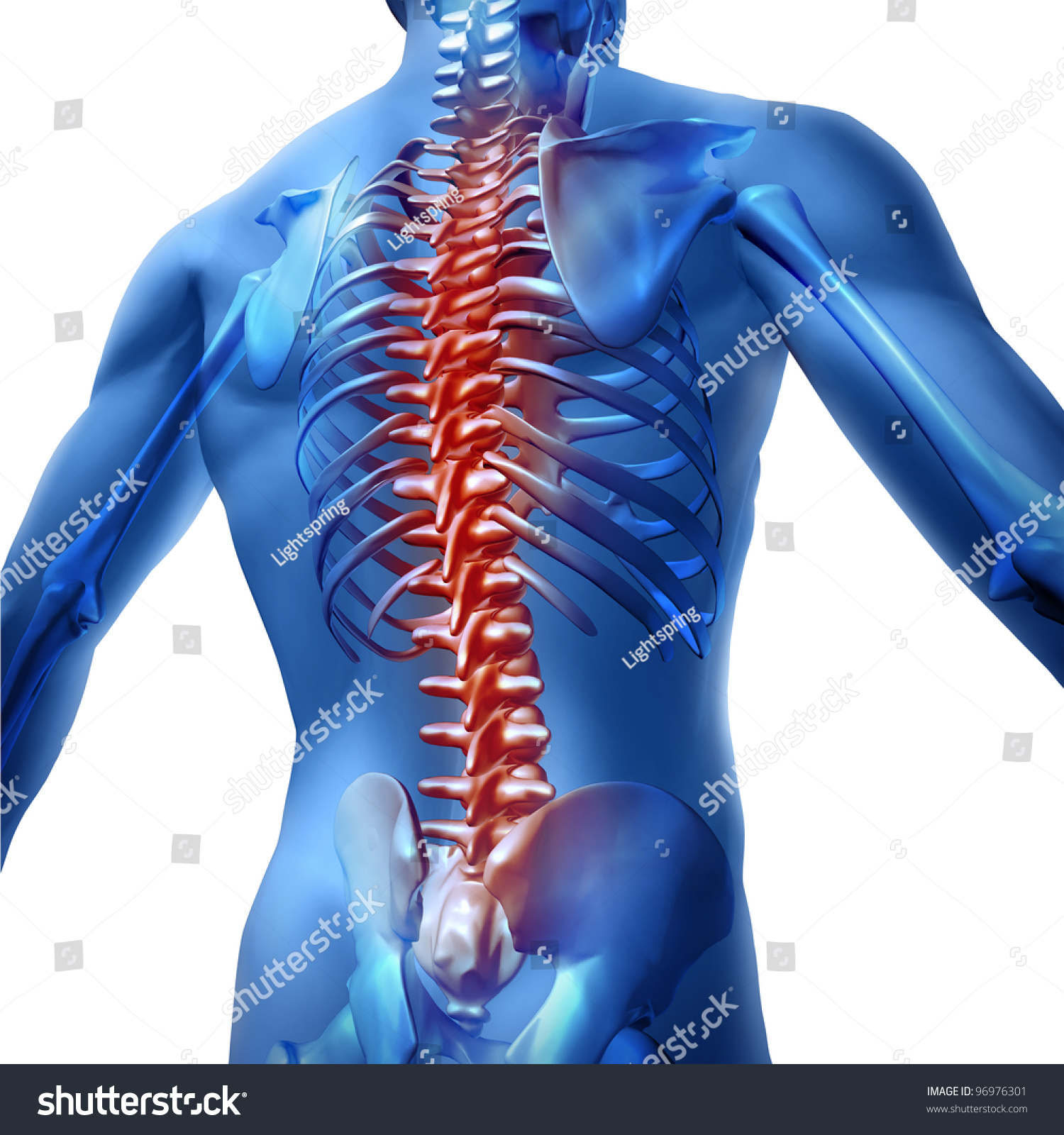 Human Body Backache And Back Pain With An Upper Royalty Free Stock Photo 96976301 Avopix Com