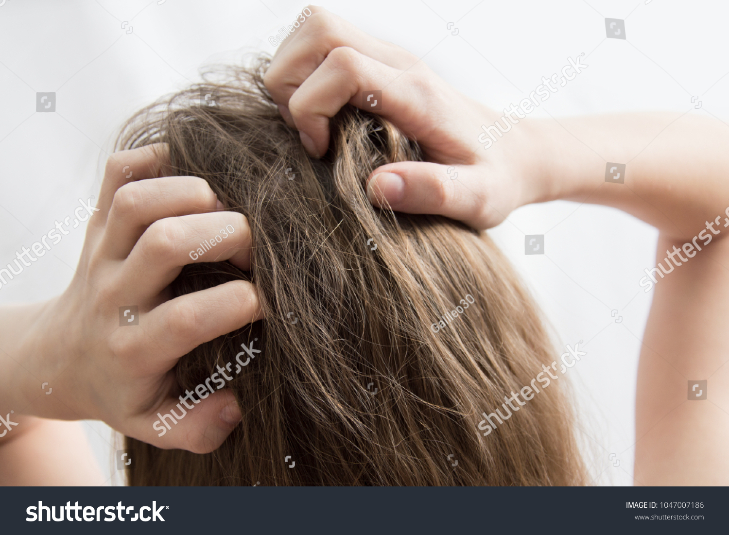 Closeup woman hand itchy scalp, Hair care concept #1047007186