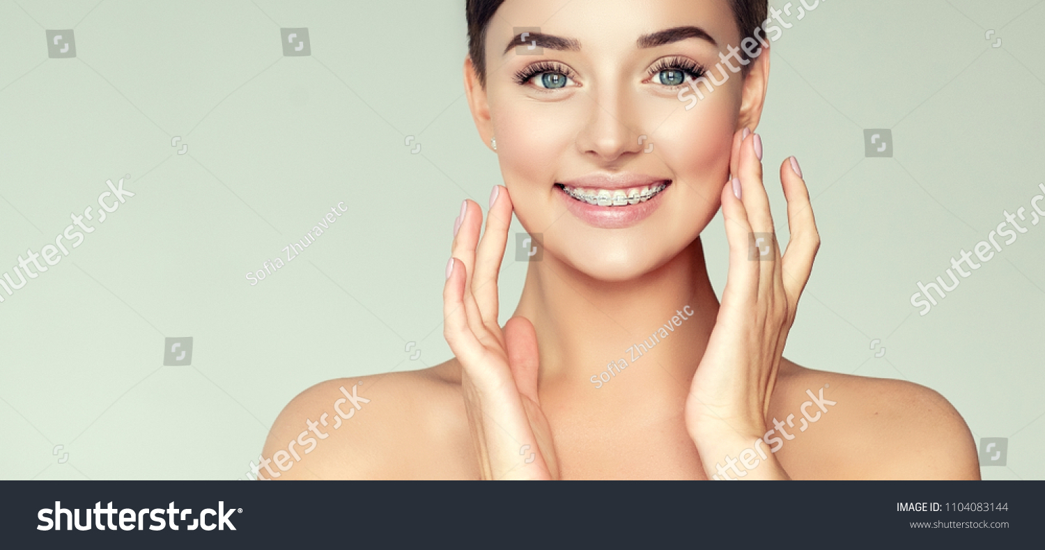 Face of a young woman with braces on her teeth . Healthy smile  #1104083144