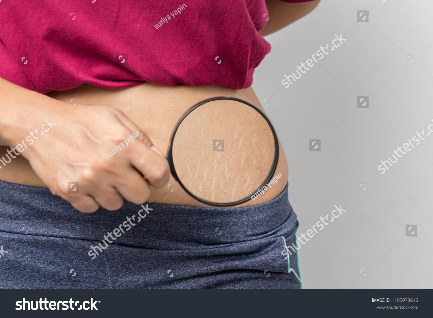 Women Show off the belly after birth. Stretch Marks on white background #1105073645