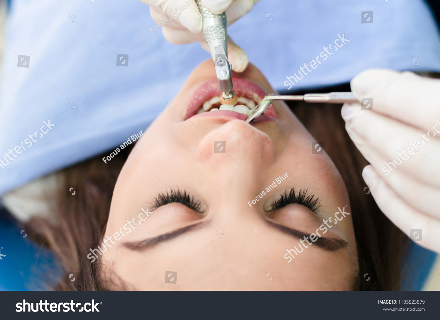 Above view of young patient at dentist office, getting her teeth polished with prophylactic paste. #1185523879