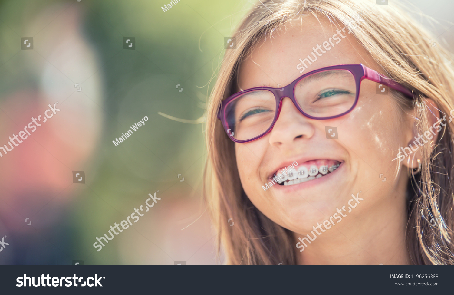 Portrait of a happy smiling teenage girl with dental braces and glasses. #1196256388