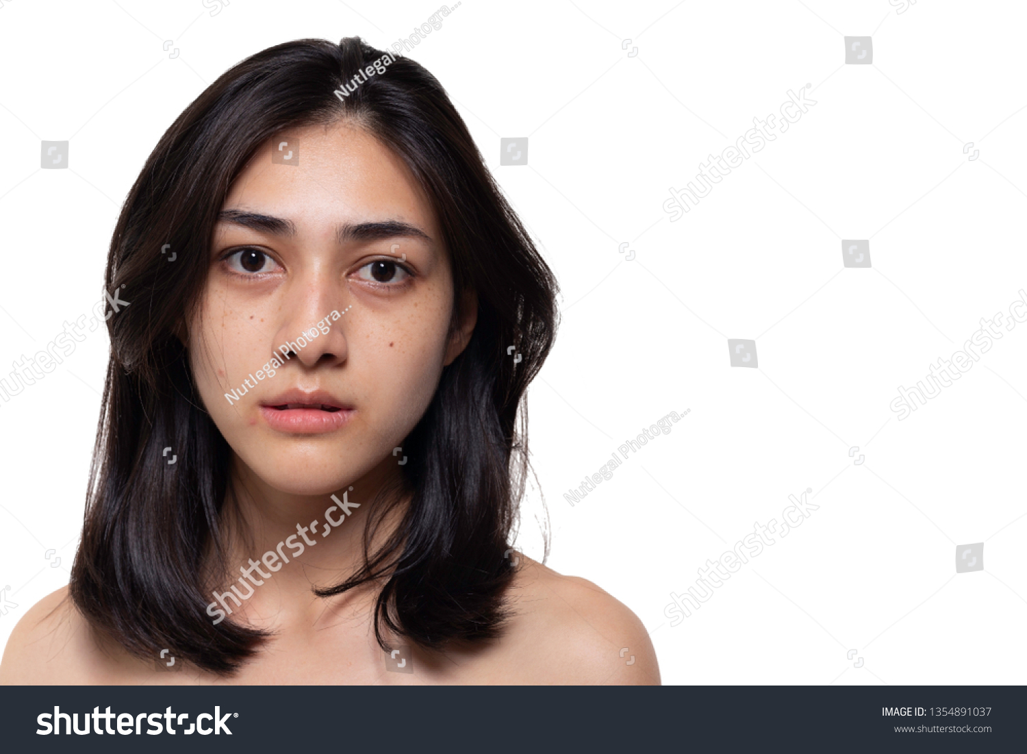 Beautiful asian woman gets freckles, blemish, pimple or acne and dull skin on her face. Charming beautiful young woman get problems of her skin. She looks unhappy. isolated on white, copy space #1354891037