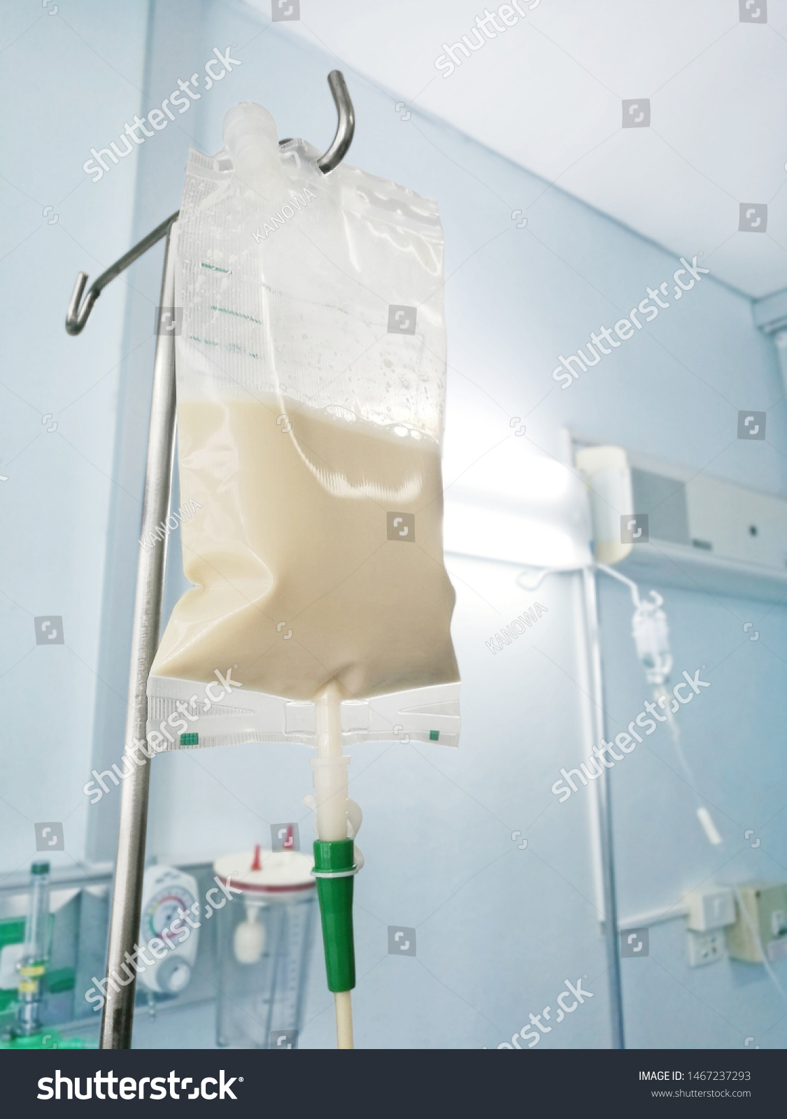 Enteral feeding bag on IV pole in patian room. #1467237293