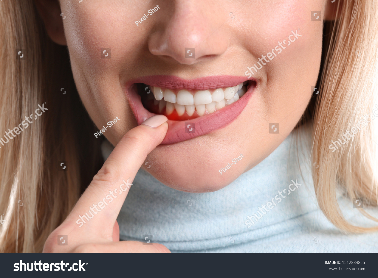 Woman with gum inflammation, closeup #1512839855